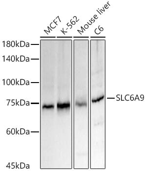 Western blot analysis of extracts of various cell lines, using Anti-SLC6A9 Antibody (A16203) at 1:1,000 dilution.
Secondary antibody: Goat Anti-Rabbit IgG (H+L) (HRP) (AS014) at 1:10,000 dilution.
Lysates / proteins: 25µg per lane.
Blocking buffer: 3% non-fat dry milk in TBST.
Detection: ECL Basic Kit (RM00020).
Exposure time: 10s.