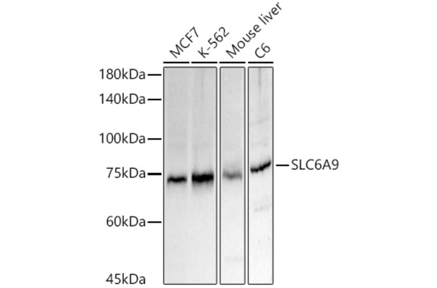Western Blot - Anti-Glyt1A Antibody (A91194) - Antibodies.com