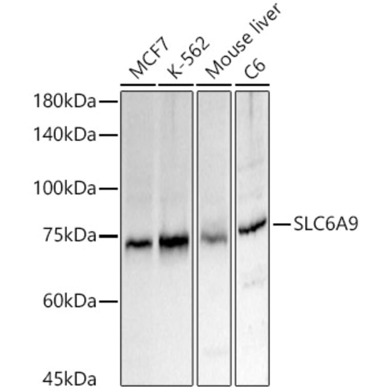 Western Blot - Anti-Glyt1A Antibody (A91194) - Antibodies.com