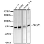 Western Blot - Anti-Glyt1A Antibody (A91194) - Antibodies.com