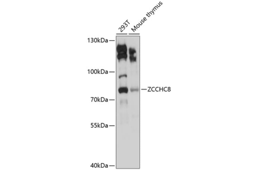 Western Blot - Anti-ZCCHC8 Antibody (A9563) - Antibodies.com