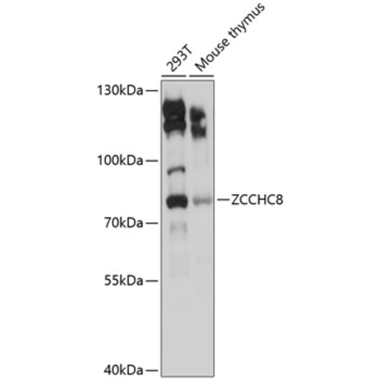 Western Blot - Anti-ZCCHC8 Antibody (A9563) - Antibodies.com