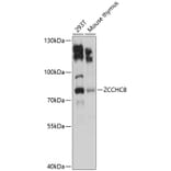 Western Blot - Anti-ZCCHC8 Antibody (A9563) - Antibodies.com