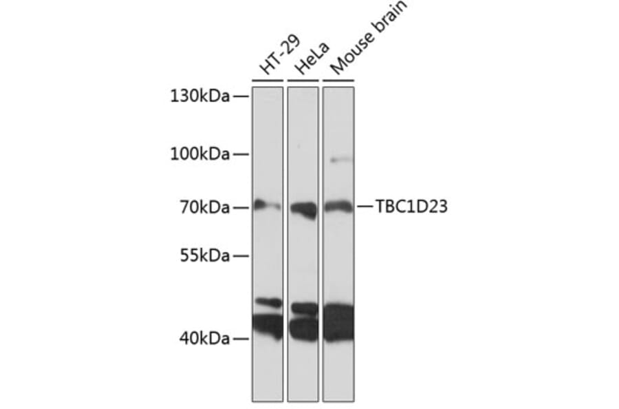 Western Blot - Anti-TBC1D23 Antibody (A91198) - Antibodies.com