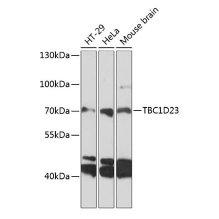 Western Blot - Anti-TBC1D23 Antibody (A91198) - Antibodies.com