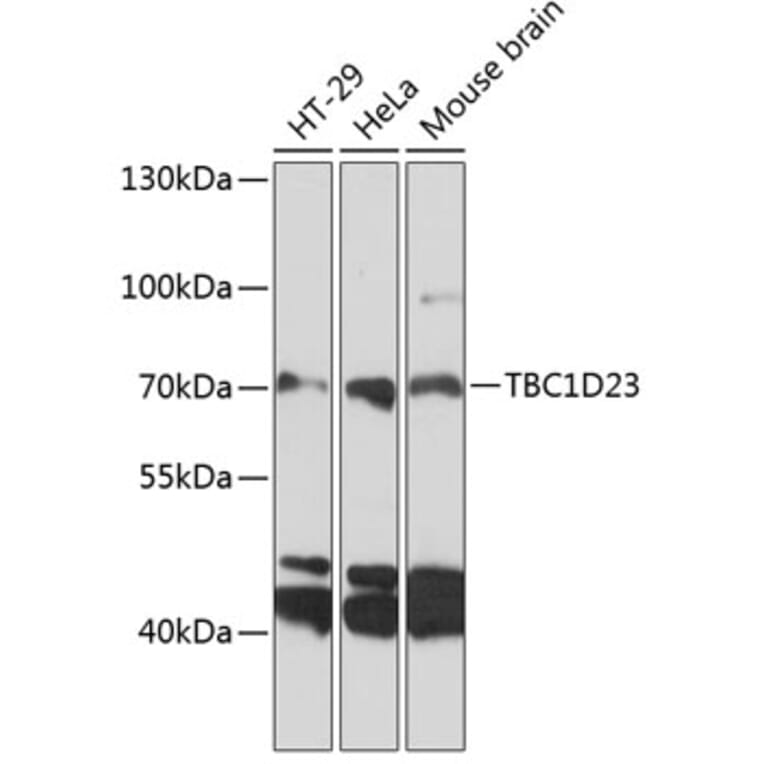 Western Blot - Anti-TBC1D23 Antibody (A91198) - Antibodies.com