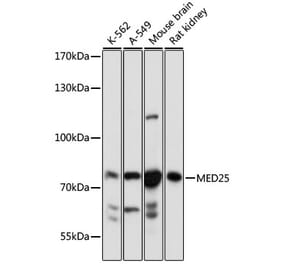 Western Blot - Anti-MED25 Antibody (A91199) - Antibodies.com