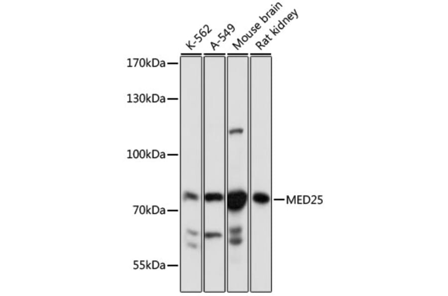 Western Blot - Anti-MED25 Antibody (A91199) - Antibodies.com