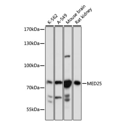 Western Blot - Anti-MED25 Antibody (A91199) - Antibodies.com