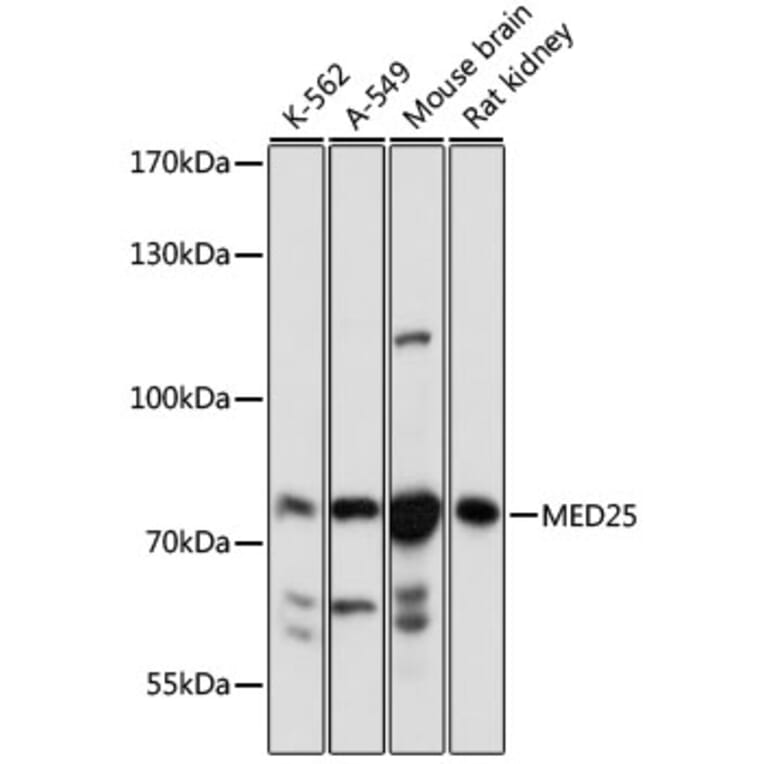 Western Blot - Anti-MED25 Antibody (A91199) - Antibodies.com