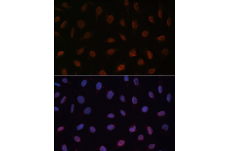 Immunofluorescence - Anti-MED25 Antibody (A91199) - Antibodies.com