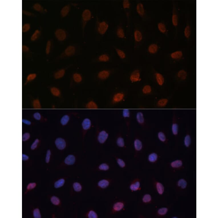 Immunofluorescence - Anti-MED25 Antibody (A91199) - Antibodies.com