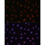 Immunofluorescence - Anti-MED25 Antibody (A91199) - Antibodies.com