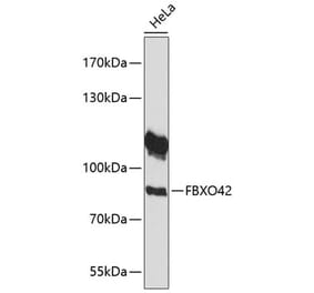 Western Blot - Anti-FBXO42 Antibody (A91201) - Antibodies.com