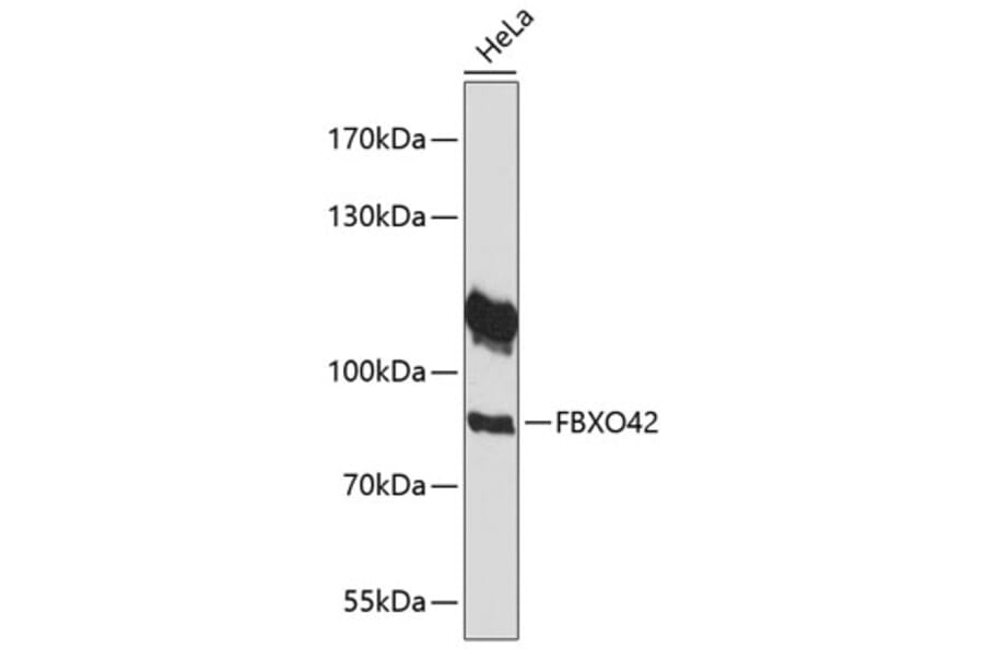 Western Blot - Anti-FBXO42 Antibody (A91201) - Antibodies.com