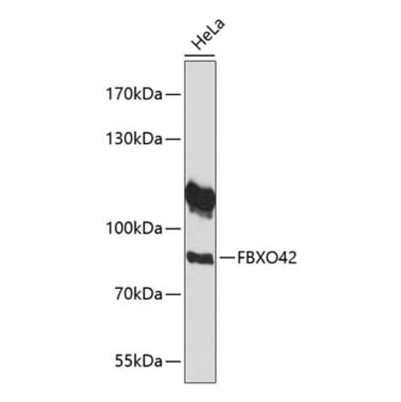 Western Blot - Anti-FBXO42 Antibody (A91201) - Antibodies.com