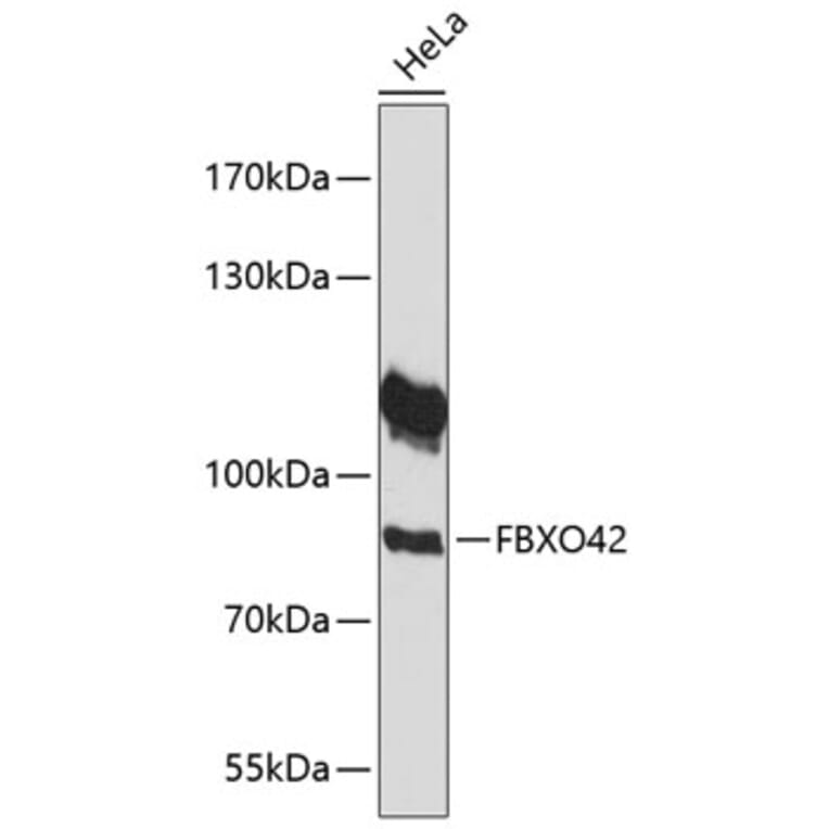 Western Blot - Anti-FBXO42 Antibody (A91201) - Antibodies.com