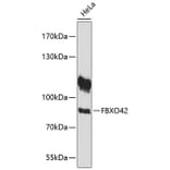 Western Blot - Anti-FBXO42 Antibody (A91201) - Antibodies.com