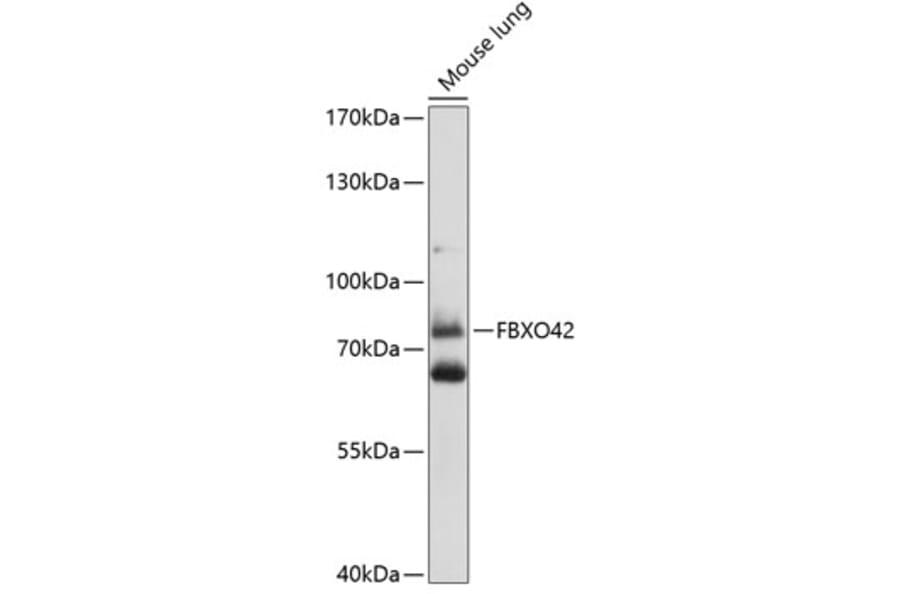 Western Blot - Anti-FBXO42 Antibody (A91202) - Antibodies.com