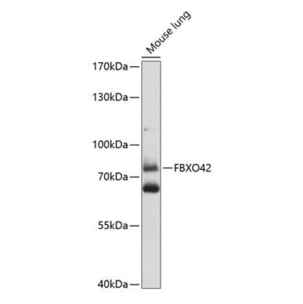 Western Blot - Anti-FBXO42 Antibody (A91202) - Antibodies.com