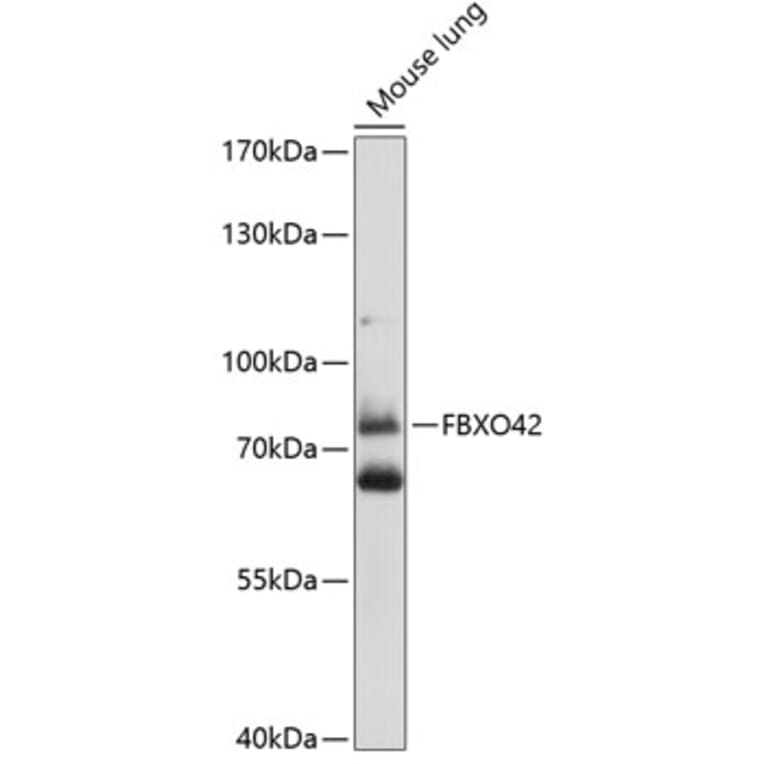 Western Blot - Anti-FBXO42 Antibody (A91202) - Antibodies.com