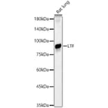 Western Blot - Anti-Lactoferrin Antibody (A91203) - Antibodies.com