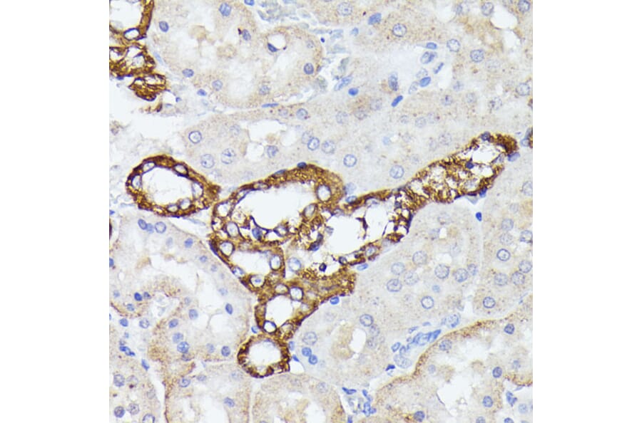 Immunohistochemistry - Anti-Lactoferrin Antibody (A91203) - Antibodies.com