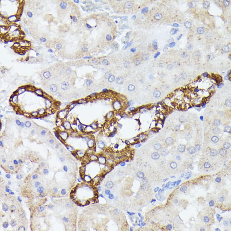 Immunohistochemistry - Anti-Lactoferrin Antibody (A91203) - Antibodies.com