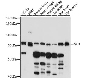 Western Blot - Anti-ME3 Antibody (A91204) - Antibodies.com