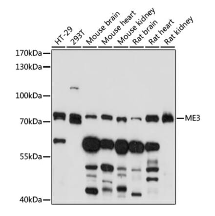 Western Blot - Anti-ME3 Antibody (A91204) - Antibodies.com