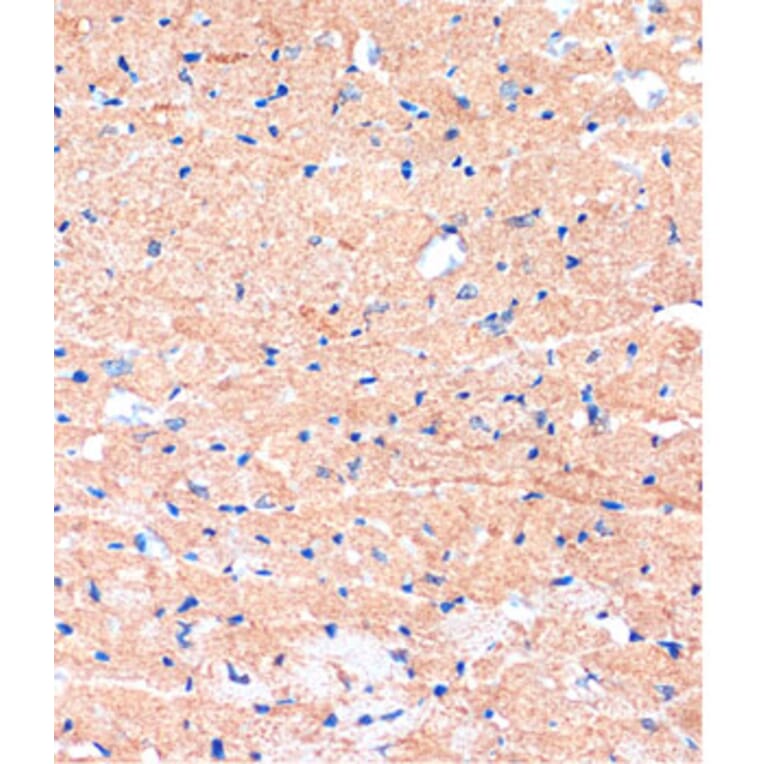 Immunohistochemistry - Anti-ME3 Antibody (A91204) - Antibodies.com