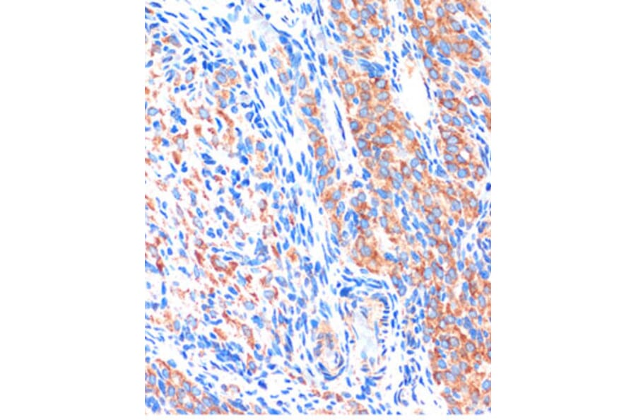 Immunohistochemistry - Anti-ME3 Antibody (A91204) - Antibodies.com