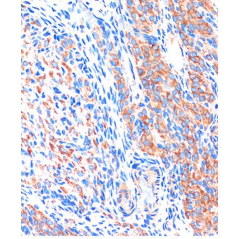 Immunohistochemistry - Anti-ME3 Antibody (A91204) - Antibodies.com