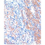Immunohistochemistry - Anti-ME3 Antibody (A91204) - Antibodies.com