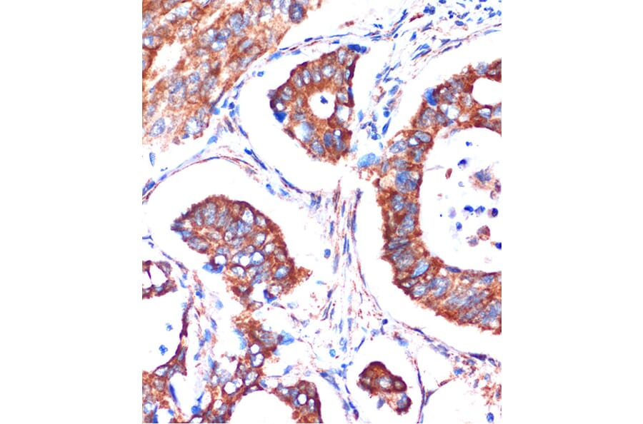 Immunohistochemistry - Anti-ME3 Antibody (A91204) - Antibodies.com