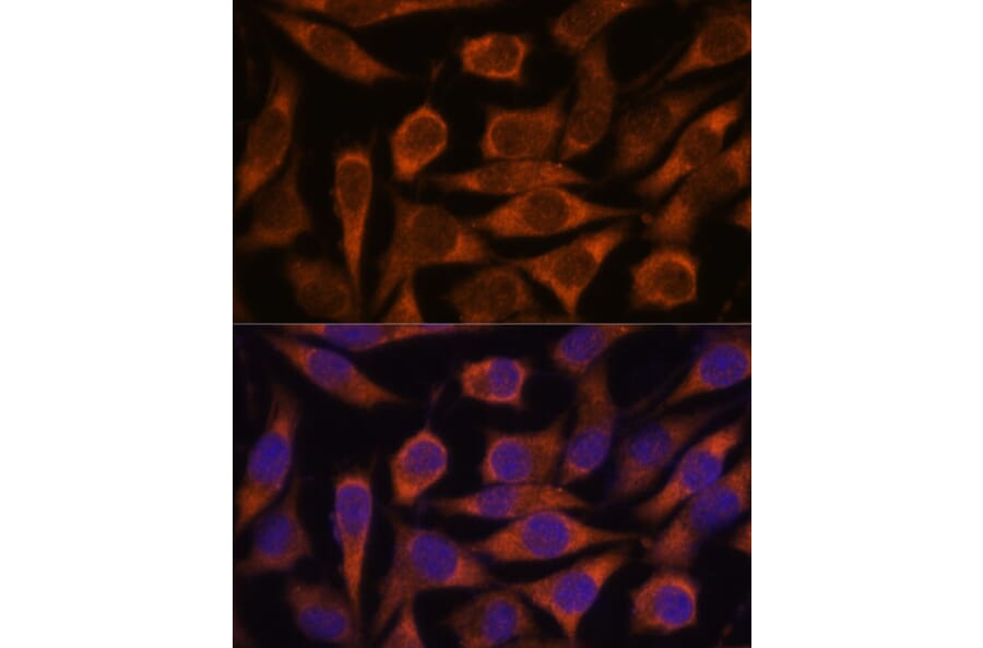 Immunofluorescence - Anti-ME3 Antibody (A91204) - Antibodies.com