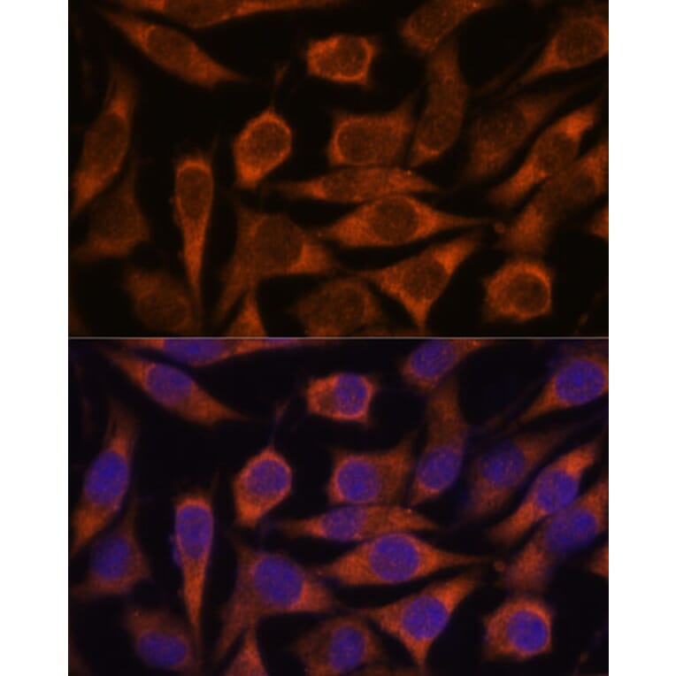 Immunofluorescence - Anti-ME3 Antibody (A91204) - Antibodies.com