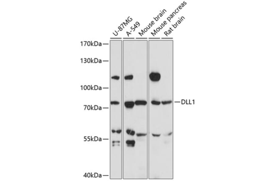 Western Blot - Anti-DLL1 Antibody (A91205) - Antibodies.com