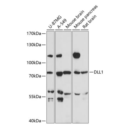 Western Blot - Anti-DLL1 Antibody (A91205) - Antibodies.com
