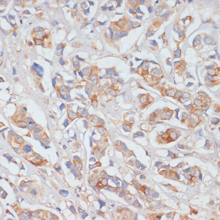 Immunohistochemistry - Anti-DLL1 Antibody (A91205) - Antibodies.com