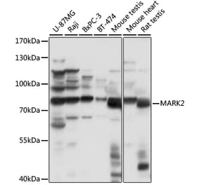 Western Blot - Anti-MARK2 Antibody (A91206) - Antibodies.com
