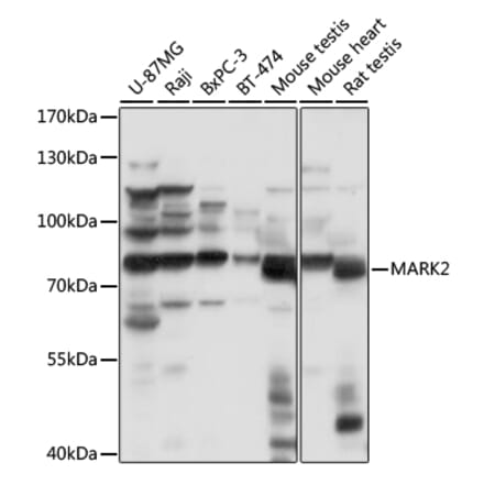 Western Blot - Anti-MARK2 Antibody (A91206) - Antibodies.com
