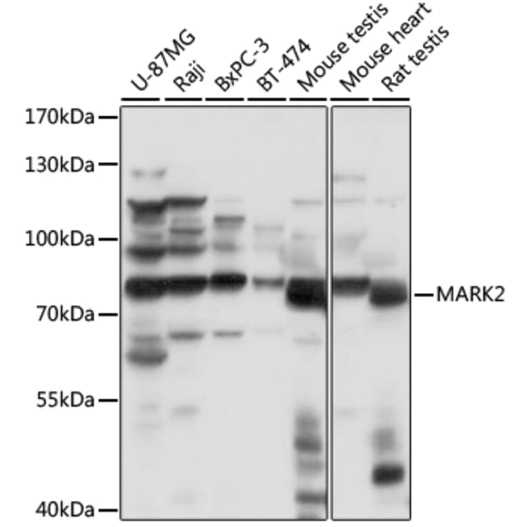 Western Blot - Anti-MARK2 Antibody (A91206) - Antibodies.com