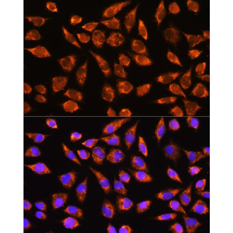 Immunofluorescence - Anti-MARK2 Antibody (A91206) - Antibodies.com
