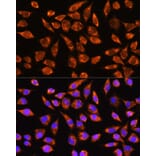 Immunofluorescence - Anti-MARK2 Antibody (A91206) - Antibodies.com