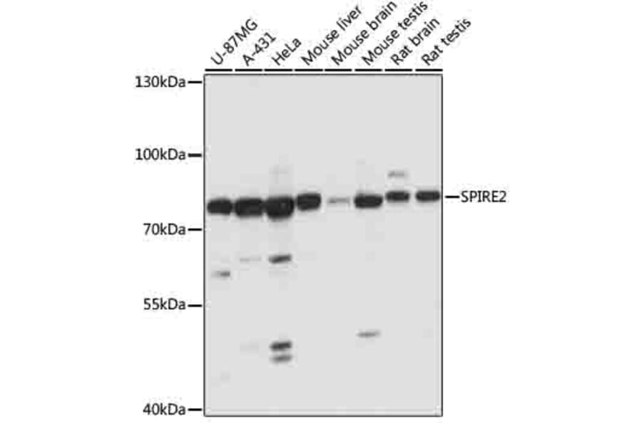 Western Blot - Anti-SPIRE2 Antibody (A91207) - Antibodies.com