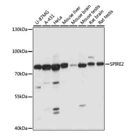 Western Blot - Anti-SPIRE2 Antibody (A91207) - Antibodies.com