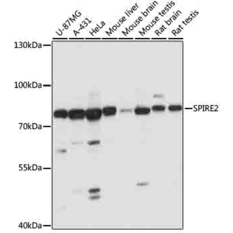 Western Blot - Anti-SPIRE2 Antibody (A91207) - Antibodies.com