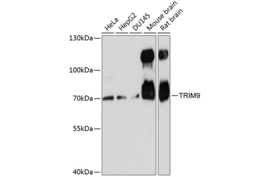 Western Blot - Anti-TRIM9 Antibody (A91208) - Antibodies.com
