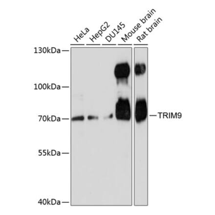 Western Blot - Anti-TRIM9 Antibody (A91208) - Antibodies.com